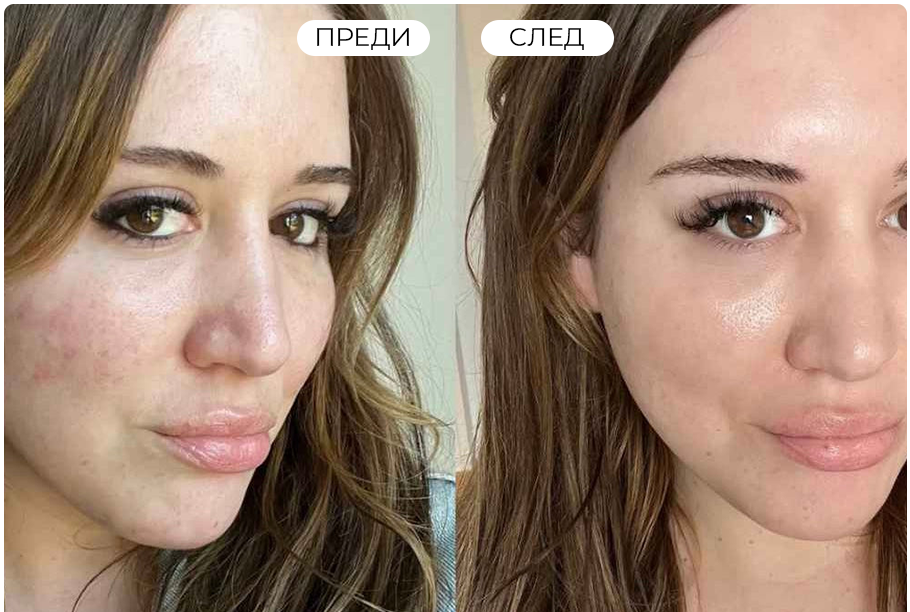 Skin improvement image