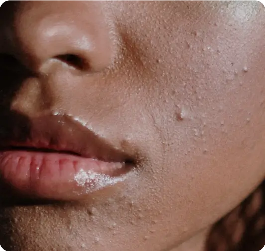 Skin improvement image