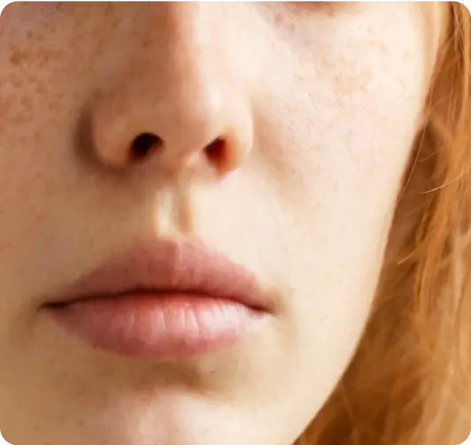 Skin improvement image