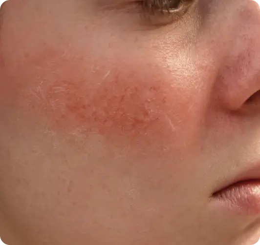 Skin improvement image