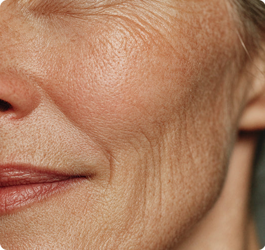 Skin improvement image