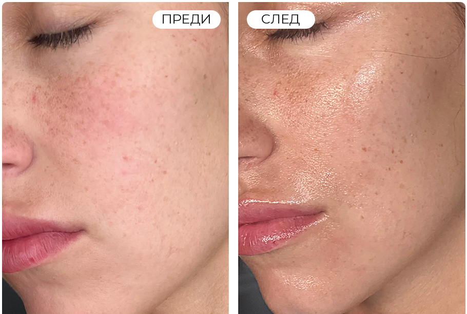 Skin improvement image